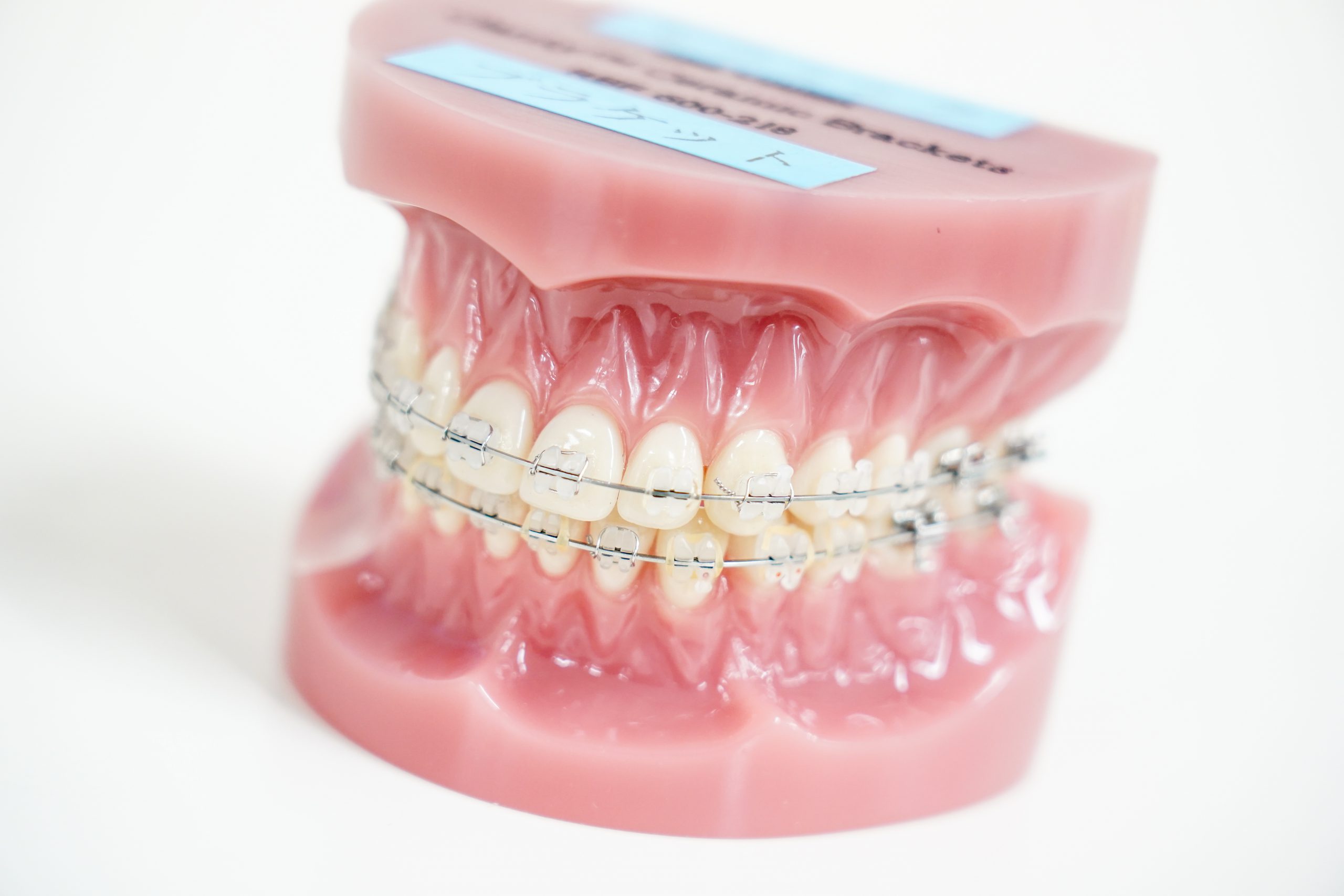 歯並びに関する治療