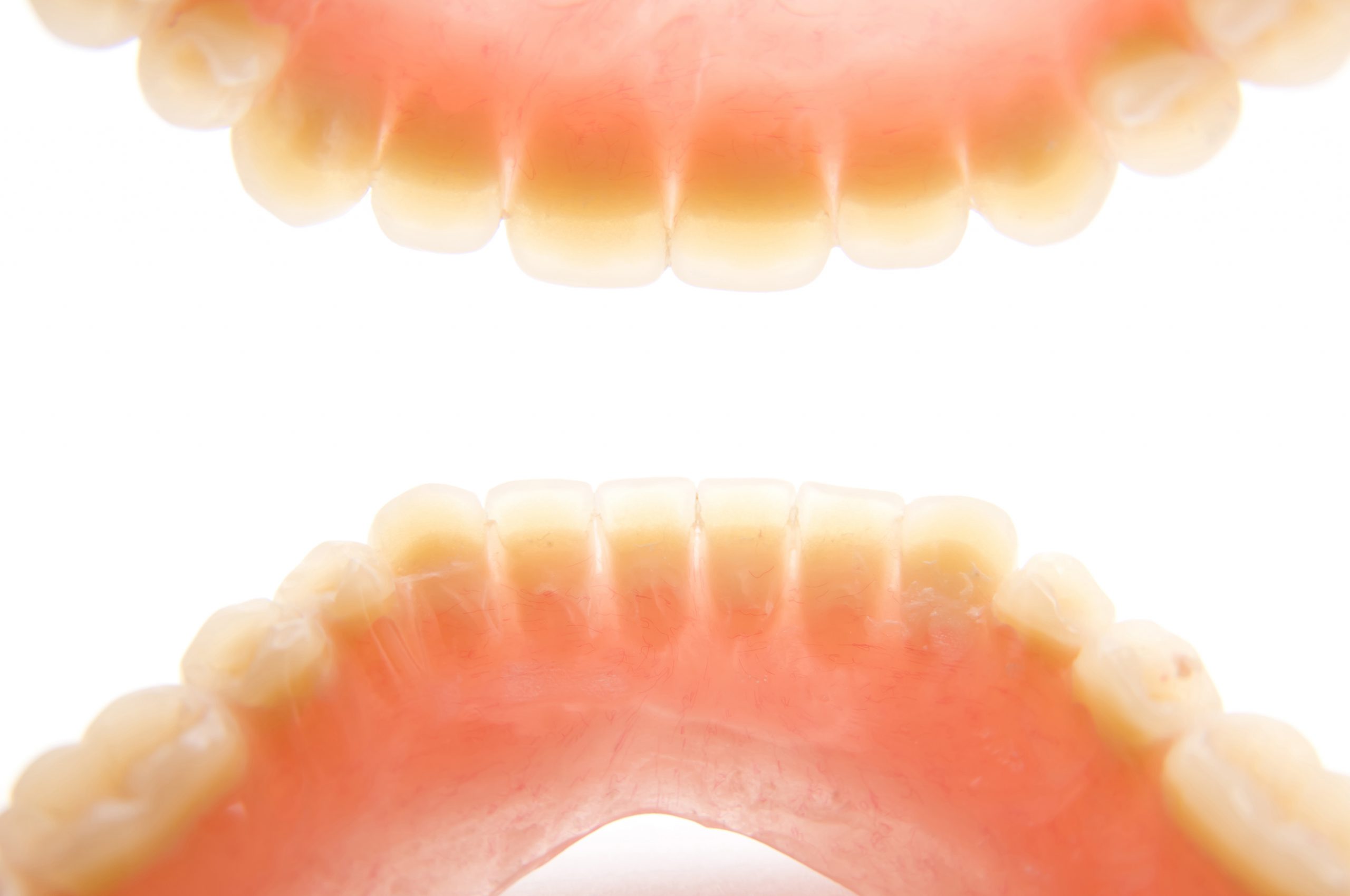 歯の形態に関する治療